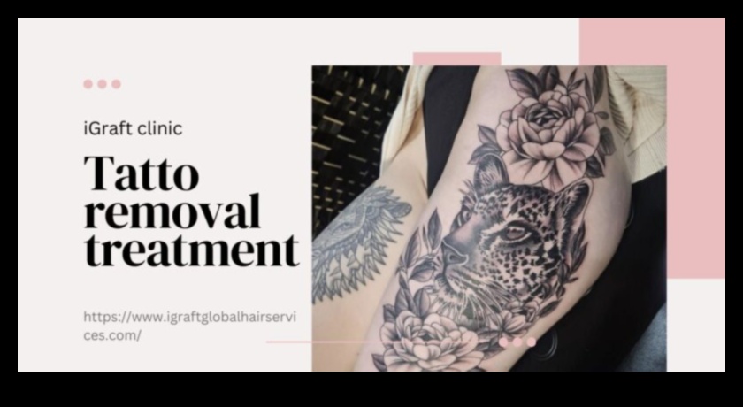 Precizitātes māksla Ieskats jaunākajās tetovēšanas tehnikās 4 Precizitātes māksla: jaunāko tetovēšanas metožu atklāšana